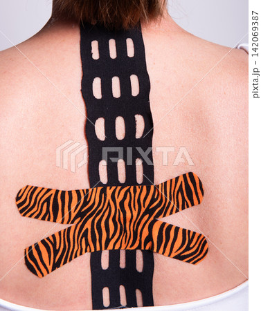 Kinesiology taping on back, black perforated and tiger pattern medical tape Kinesiology taping on back, black perforated and tiger pattern medical tape 142069387