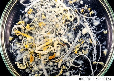 Freshwater Trematode Parasites: Clinostomum, Postorchigenes and Thapariella spp. for education in Lab. Freshwater Trematode Parasites: Clinostomum, Postorchigenes and Thapariella spp. for education in Lab. 142122178