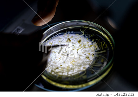 Freshwater Trematode Parasites: Clinostomum, Postorchigenes and Thapariella spp. for education in Lab. Freshwater Trematode Parasites: Clinostomum, Postorchigenes and Thapariella spp. for education in Lab. 142122212