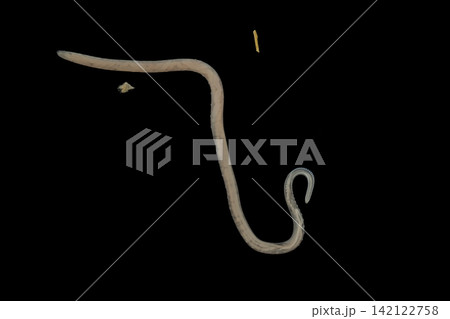 Freshwater Trematode Parasites: Clinostomum, Postorchigenes and Thapariella spp. for education in Lab. Freshwater Trematode Parasites: Clinostomum, Postorchigenes and Thapariella spp. for education in Lab. 142122758