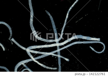 Freshwater Trematode Parasites: Clinostomum, Postorchigenes and Thapariella spp. for education in Lab. Freshwater Trematode Parasites: Clinostomum, Postorchigenes and Thapariella spp. for education in Lab. 142122761