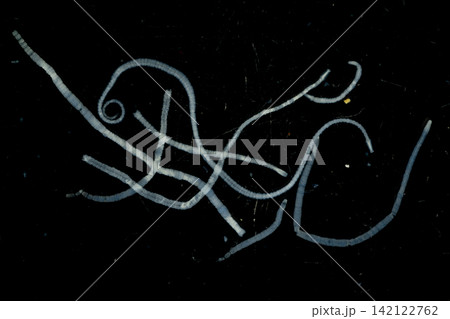 Freshwater Trematode Parasites: Clinostomum, Postorchigenes and Thapariella spp. for education in Lab. Freshwater Trematode Parasites: Clinostomum, Postorchigenes and Thapariella spp. for education in Lab. 142122762