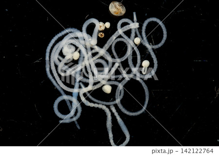 Freshwater Trematode Parasites: Clinostomum, Postorchigenes and Thapariella spp. for education in Lab. Freshwater Trematode Parasites: Clinostomum, Postorchigenes and Thapariella spp. for education in Lab. 142122764