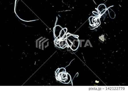 Freshwater Trematode Parasites: Clinostomum, Postorchigenes and Thapariella spp. for education in Lab. Freshwater Trematode Parasites: Clinostomum, Postorchigenes and Thapariella spp. for education in Lab. 142122770