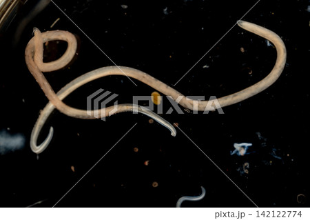 Freshwater Trematode Parasites: Clinostomum, Postorchigenes and Thapariella spp. for education in Lab. Freshwater Trematode Parasites: Clinostomum, Postorchigenes and Thapariella spp. for education in Lab. 142122774