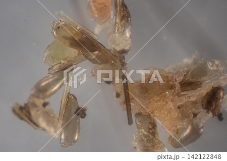 Human Head Louse and Nits (Pediculus humanus capitis) Attached to Human Hair Under Microscope | Microscopic Close-Up of Lice Infestation. Human Head Louse and Nits (Pediculus humanus capitis) Attached to Human Hair Under Microscope | Microscopic Close-Up of Lice Infestation. 142122848