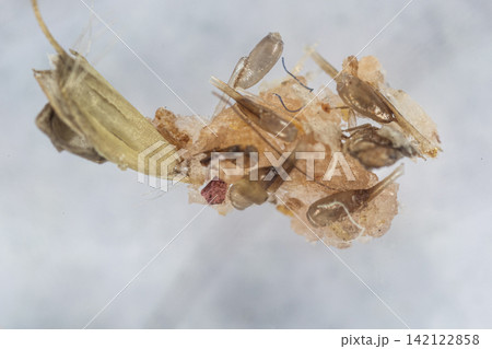 Human Head Louse and Nits (Pediculus humanus capitis) Attached to Human Hair Under Microscope | Microscopic Close-Up of Lice Infestation. Human Head Louse and Nits (Pediculus humanus capitis) Attached to Human Hair Under Microscope | Microscopic Close-Up of Lice Infestation. 142122858