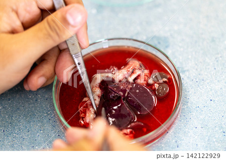 Freshwater Trematode Parasites: Clinostomum, Postorchigenes and Thapariella spp. for education in Lab. 142122929