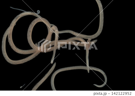 Freshwater Trematode Parasites: Clinostomum, Postorchigenes and Thapariella spp. for education in Lab. 142122952