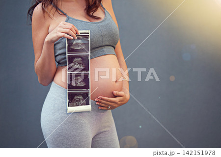 Woman, pregnant and holding belly with sonogram in studio for maternity shoot, album and baby shower. Mother, growth and ultrasound isolated on gray background for gender reveal and surrogacy Woman, pregnant and holding belly with sonogram in studio for maternity shoot, album and baby shower. Mother, growth and ultrasound isolated on gray background for gender reveal and surrogacy 142151978
