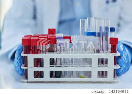 Science, blood and hands of doctor with test tube for biotech engineering, pathology and hematology research. Laboratory, investigation and scientist checking diabetes development for medical study Science, blood and hands of doctor with test tube for biotech engineering, pathology and hematology research. Laboratory, investigation and scientist checking diabetes development for medical study 142164931