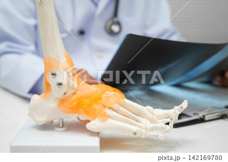 Doctor examining foot ankle  joint bone radiography xray film. 142169780