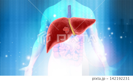 Man with Damaged human liver on medical background 142192231
