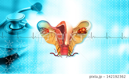Female uterus anatomy on medical background. female uterus with stethoscope 142192362