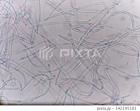 カビの菌糸が伸びる様子 142195181