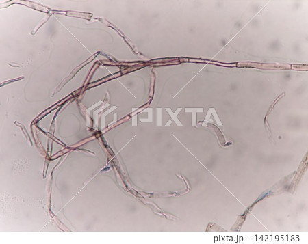 菌糸に隔壁が見られる様子 菌糸に隔壁が見られる様子 142195183