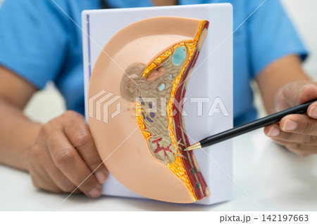 doctor holding female breast human anatomy model. doctor holding female breast human anatomy model. 142197663
