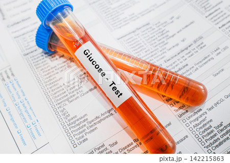 blood sample in lab test tube for Glucose test blood sample in lab test tube for Glucose test 142215863