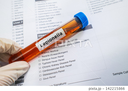 blood sample in lab test tube for Legionella test blood sample in lab test tube for Legionella test 142215866