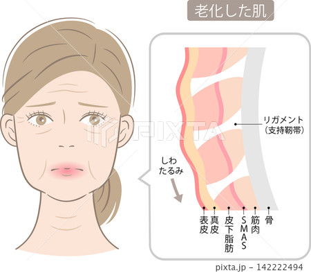 たるみとしわ　女性の顔と支持靭帯（リガメント ）のしくみ 142222494