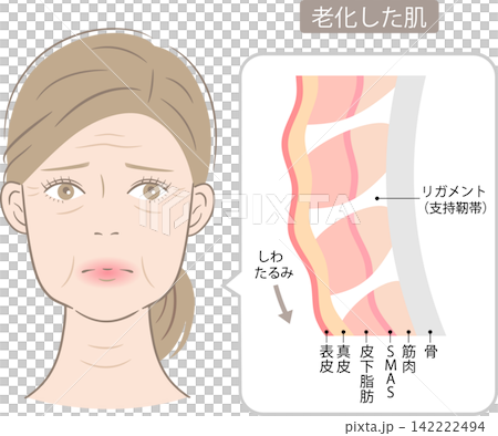 たるみとしわ　女性の顔と支持靭帯（リガメント ）のしくみ 142222494