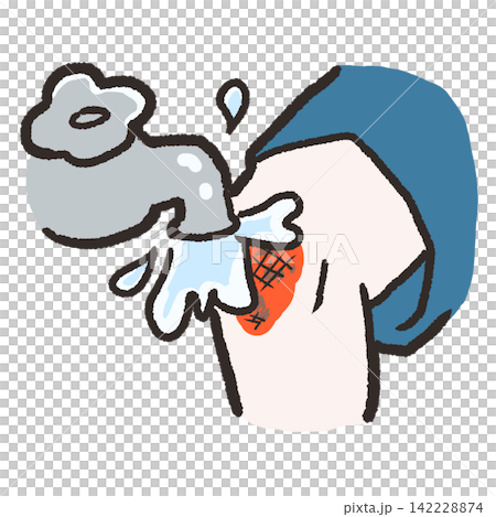 [First Aid Quiz: Correct Answer] If you scrape your knee, wash it with tap water. 142228874