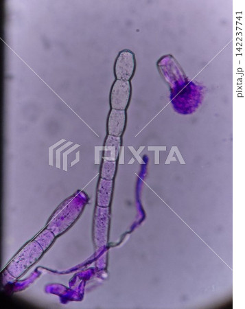 胞子が何重にも伸びる様子 142237741
