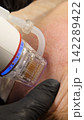 A multifunctional device for microneedle RF lifting. Aesthetic procedures for non-surgical lifting, smoothing fine lines, minimizing pores, regulating sebum production, and evening out skin texture. 142289422