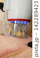A multifunctional device for microneedle RF lifting. Aesthetic procedures for non-surgical lifting, smoothing fine lines, minimizing pores, regulating sebum production, and evening out skin texture. 142289423