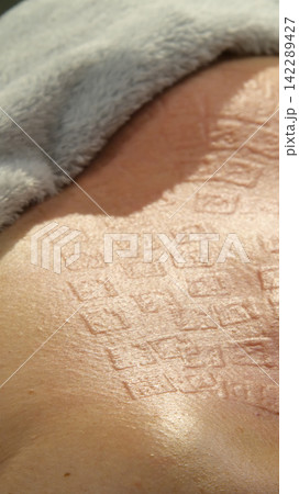A multifunctional device for microneedle RF lifting. Aesthetic procedures for non-surgical lifting, smoothing fine lines, minimizing pores, regulating sebum production, and evening out skin texture. 142289427