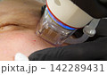 A multifunctional device for microneedle RF lifting. Aesthetic procedures for non-surgical lifting, smoothing fine lines, minimizing pores, regulating sebum production, and evening out skin texture. 142289431