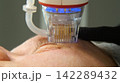 A multifunctional device for microneedle RF lifting. Aesthetic procedures for non-surgical lifting, smoothing fine lines, minimizing pores, regulating sebum production, and evening out skin texture. 142289432