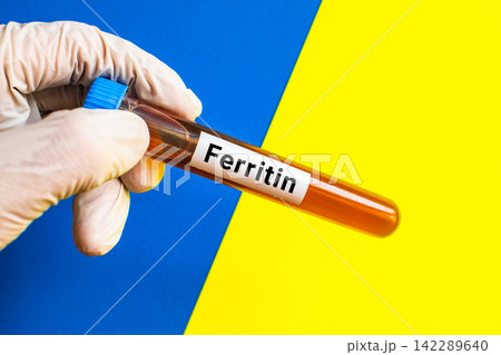 blood sample in lab tube for Ferritin test blood sample in lab tube for Ferritin test 142289640