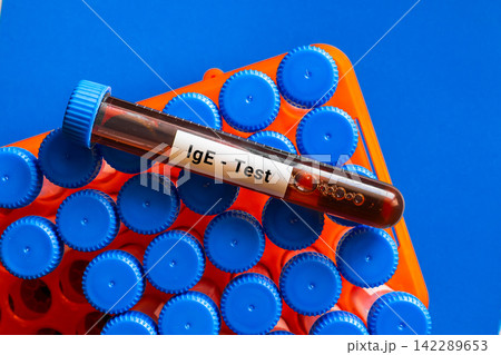 blood sample in lab tube for IgE test 142289653