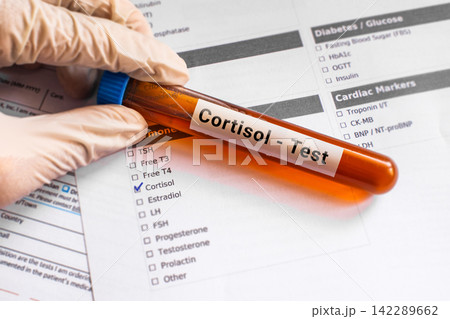 blood sample in lab tube for Cortisol test blood sample in lab tube for Cortisol test 142289662