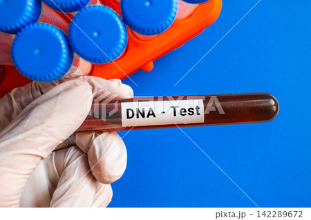 blood sample in lab tube for DNA test 142289672