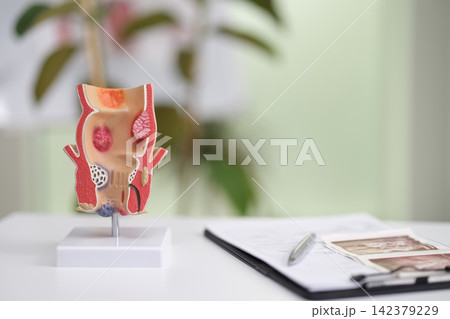 Anatomical model of human rectum for educational purposes on clinic table Anatomical model of human rectum for educational purposes on clinic table 142379229