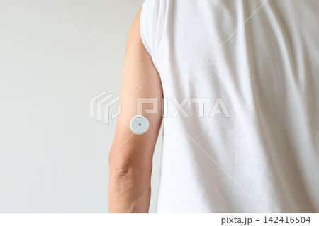 血糖値測定器を腕に装着する男性 142416504