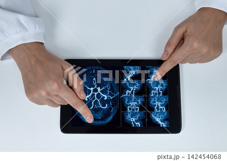 Doctors hands pointing at a digital brain angiography scan displayed on a tablet computer. Advanced neuroimaging and cerebral vascular diagnostics concept Doctors hands pointing at a digital brain angiography scan displayed on a tablet computer. Advanced neuroimaging and cerebral vascular diagnostics concept 142454068