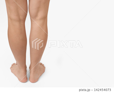 Rear view of female legs standing barefoot on a white background. Varicose veins disease treatment and flat feet diagnostics 142454073