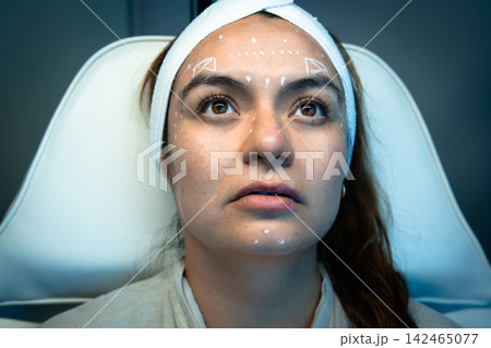 Front view of patient with white facial mapping marks Front view of patient with white facial mapping marks 142465077