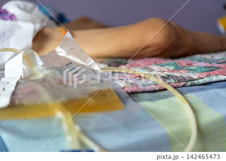 Urinary catheter drainage bag urine beside patient resting bed showing medical care equipment used for bladder drainage patient monitoring Urinary catheter drainage bag urine beside patient resting bed showing medical care equipment used for bladder drainage patient monitoring 142465473