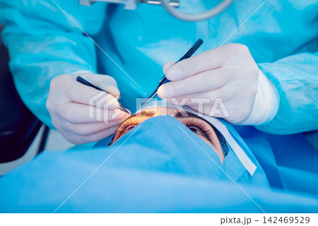 The operation on the eye The operation on the eye 142469529