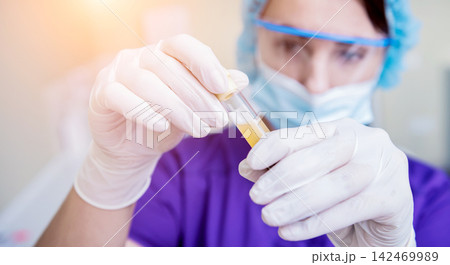 Platelet-Rich plasma preparation. Tube with plasma in hands Platelet-Rich plasma preparation. Tube with plasma in hands 142469989