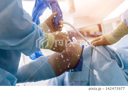 Arthroscope surgery. Orthopedic surgeons in teamwork in the operating room with modern arthroscopic tools. Knee surgery. 142473977