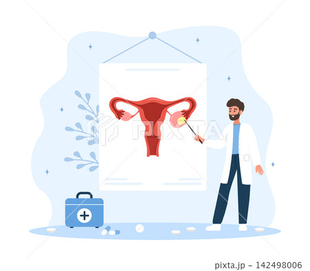 Ovarian cyst concept. Male doctor exam reproductive system. Vector illustration in flat style Ovarian cyst concept. Male doctor exam reproductive system. Vector illustration in flat style 142498006