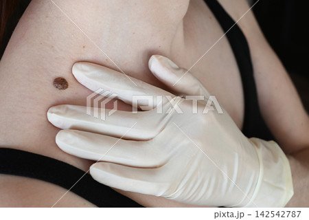 A woman examines a large mole on her neck. 142542787