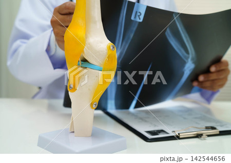 Doctor examining knee joint bone radiography xray film. Doctor examining knee joint bone radiography xray film. 142544656