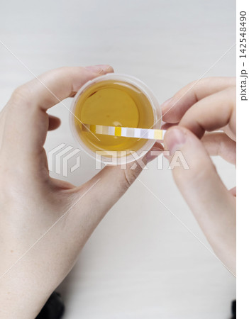 Person dipping a reagent test strip into a urine specimen container for medical analysis. Practical home diagnostic test checking health parameters and biomarkers. 142548490