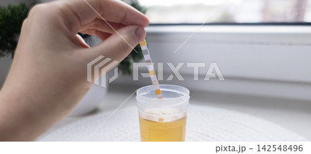 Person dipping a reagent test strip into a urine specimen container for medical analysis. Practical home diagnostic test checking health parameters and biomarkers. Person dipping a reagent test strip into a urine specimen container for medical analysis. Practical home diagnostic test checking health parameters and biomarkers. 142548496